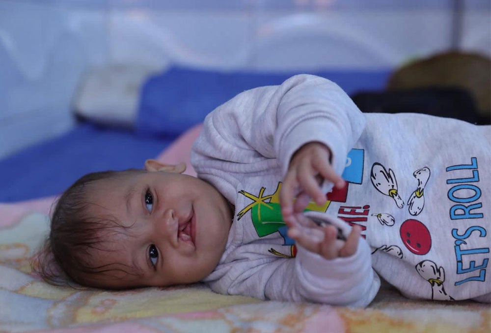 Noah before cleft surgery