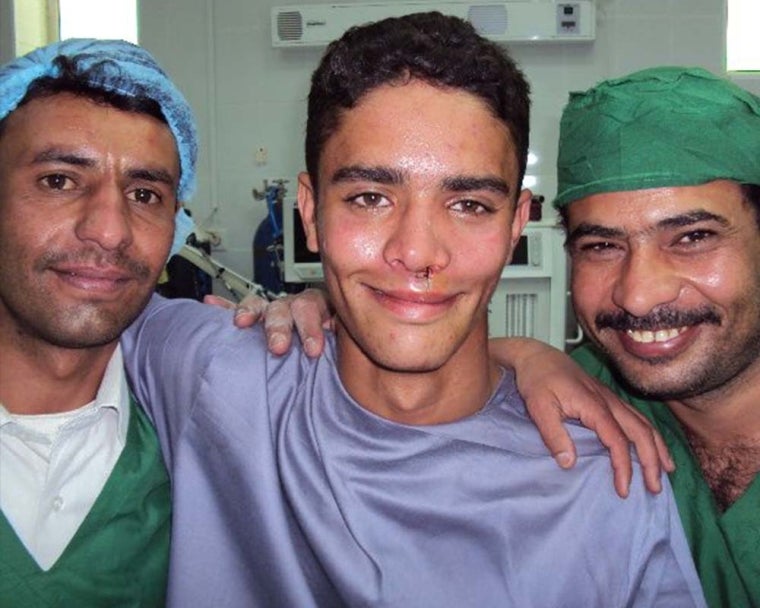 happy patient after cleft lip surgery