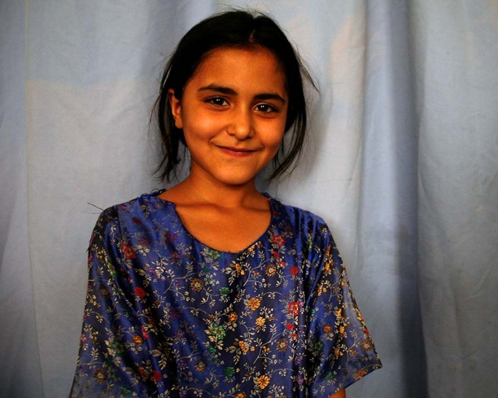 girl after cleft palate surgery